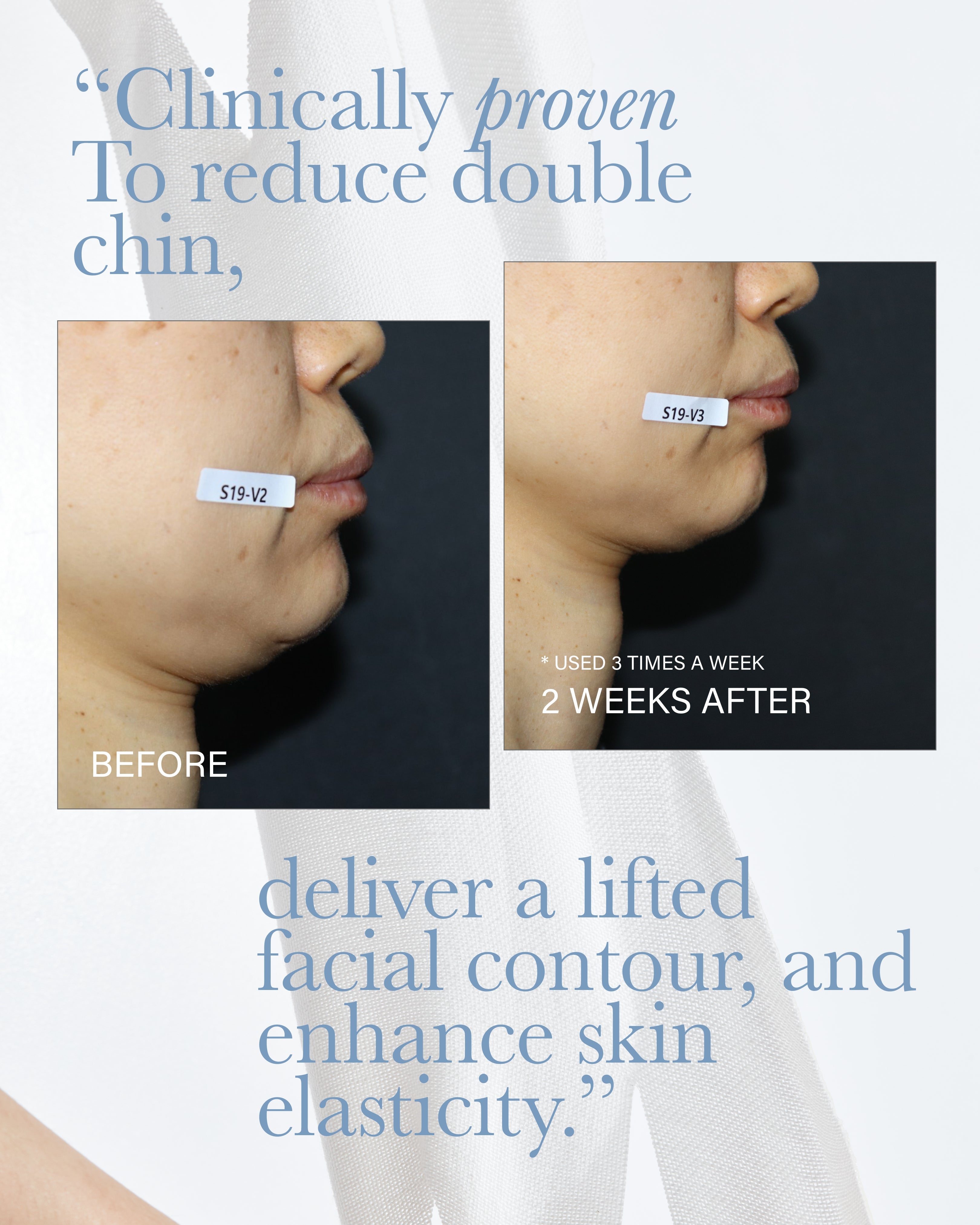 X-Lifting Mask 1 Box(5ea)